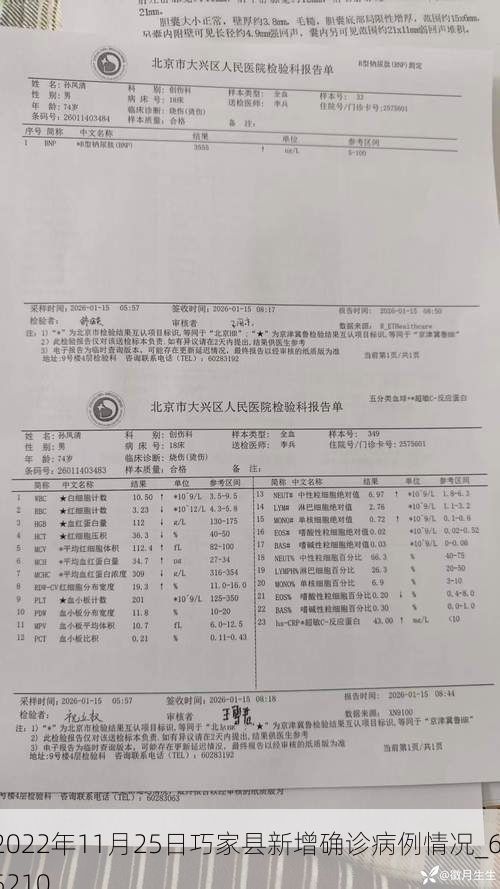 2022年11月25日巧家县新增确诊病例情况_65210