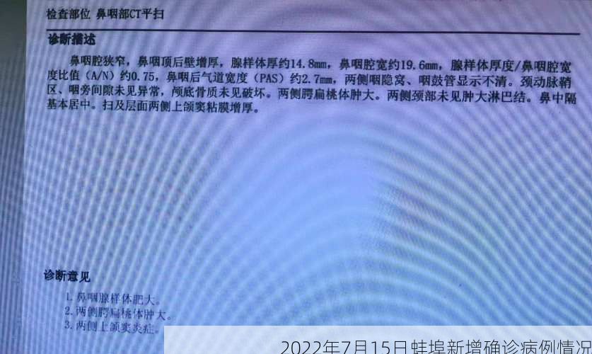 2022年7月15日蚌埠新增确诊病例情况