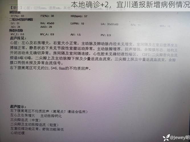 本地确诊+2,宜川通报新增病例情况