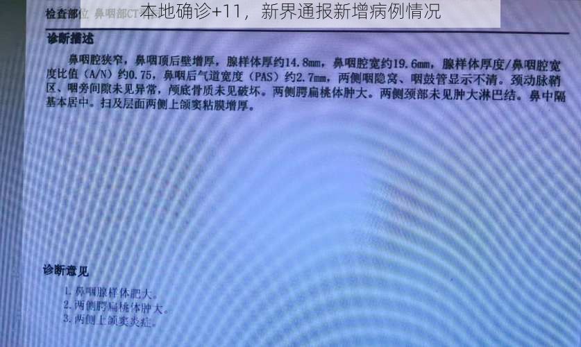 本地确诊+11，新界通报新增病例情况