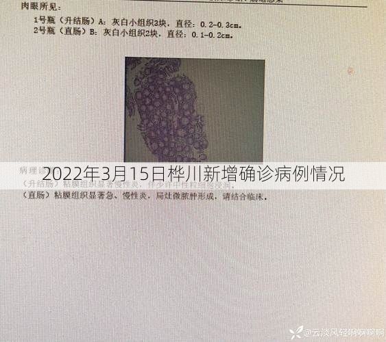 2022年3月15日桦川新增确诊病例情况